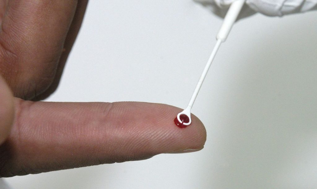 Tratamento preventivo HIV