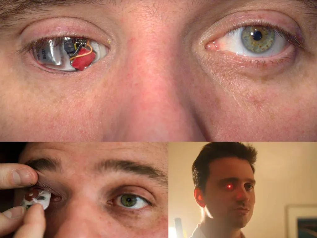 Eyeborg: tecnologia e visão