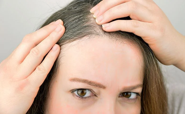 O que causa cabelo branco