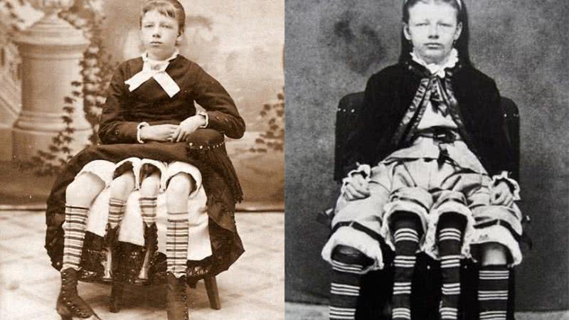 Myrtle Corbin: a mulher de quatro pernas e sua Jornada no mundo do circo