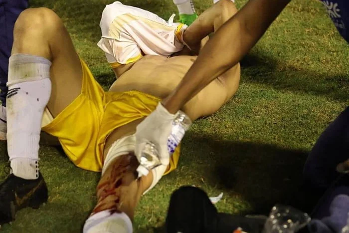 Vídeo: Goleiro é atingido por tiro de borracha disparado por policial militar em confusão após partida
