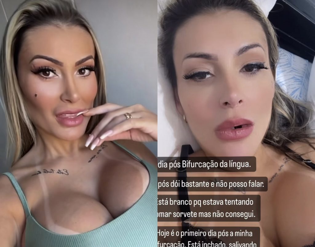 Assista: Andressa Urach choca web ao mostrar resultado de procedimento conhecido como ‘língua de cobra’