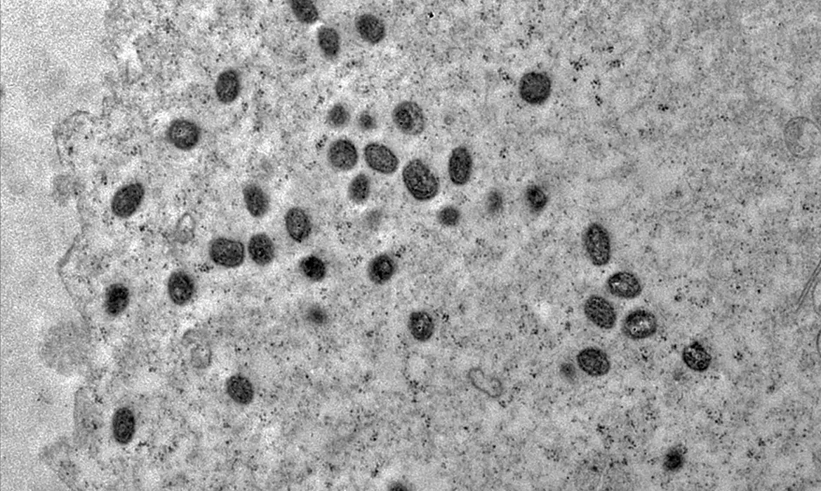 Navio que saiu do Brasil fica em quarentena na Argentina após tripulação apresentar sintomas de Mpox