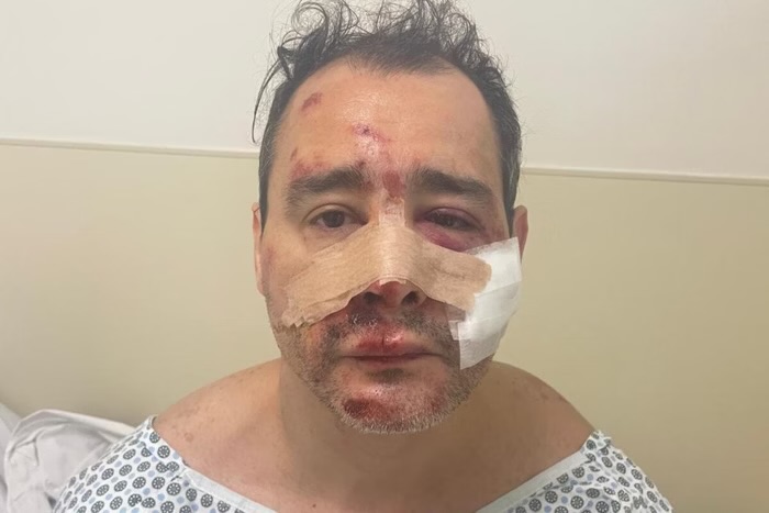 Metalúrgico é espancado com barra de ferro por causa de xixi de cão
