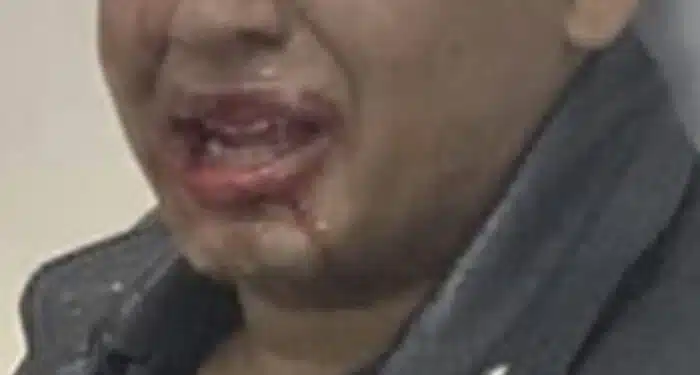 Adolescente autista é covardemente agredido em sessão de cinema