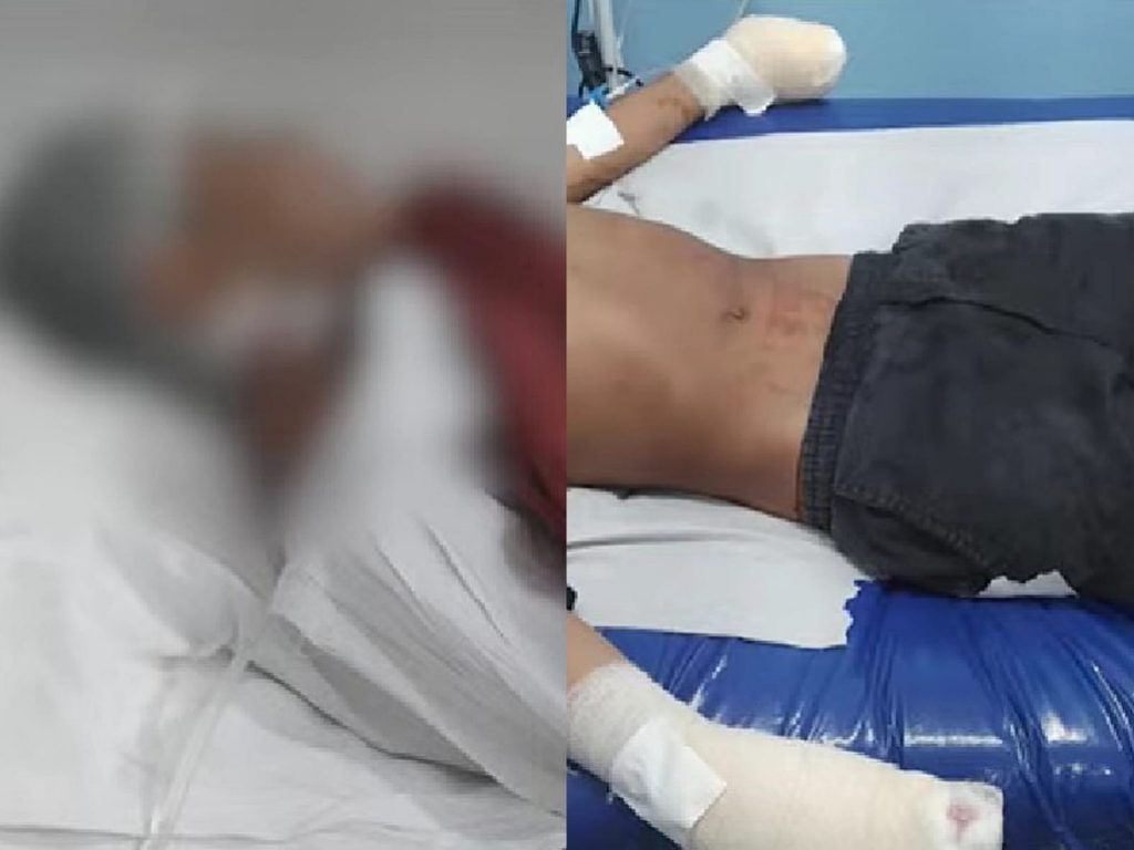 Adolescente tem dedos decepados em ‘Tribunal do Crime’ por furtar escola em Manaus