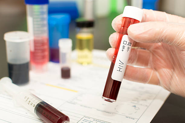 SUS pode oferecer PrEP injetável contra HIV com aplicação a cada dois meses
