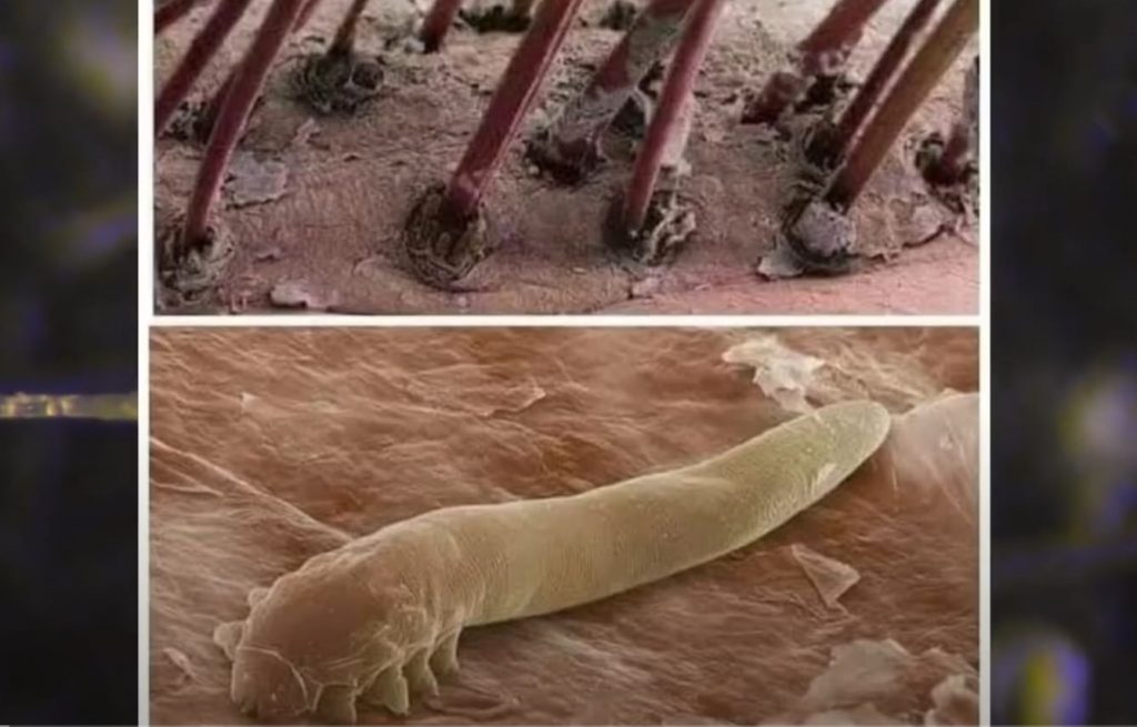 ácaro Demodex