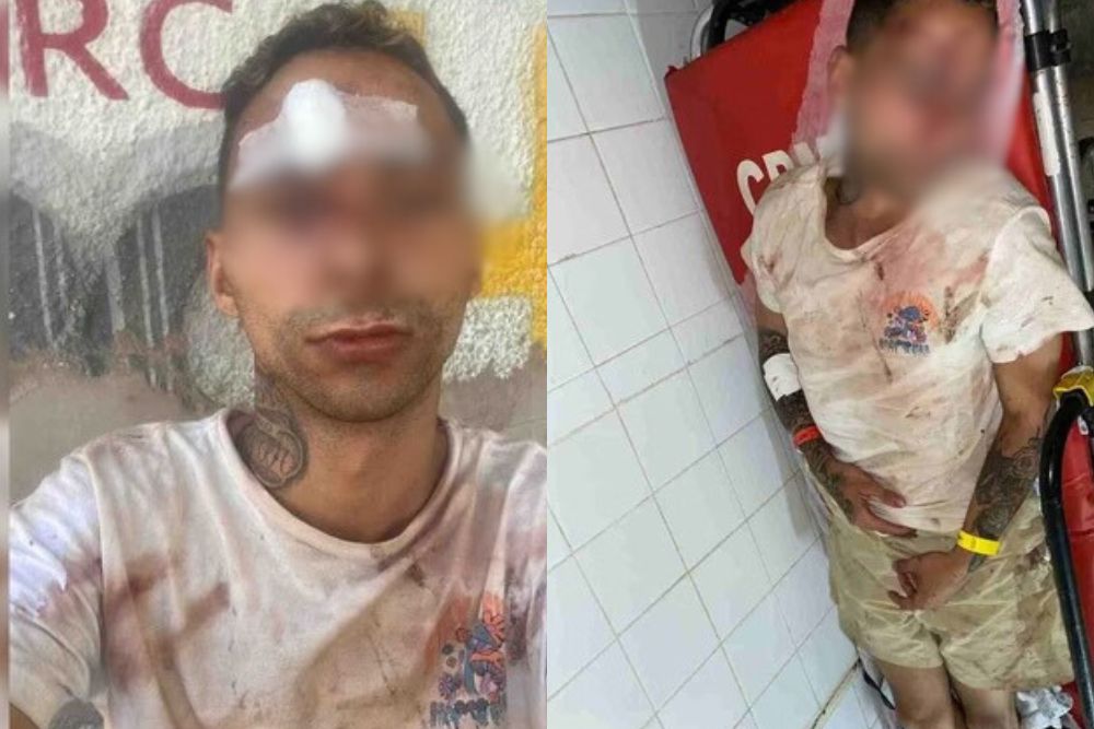 Grupo de oito homens espanca casal gay no interior de bar