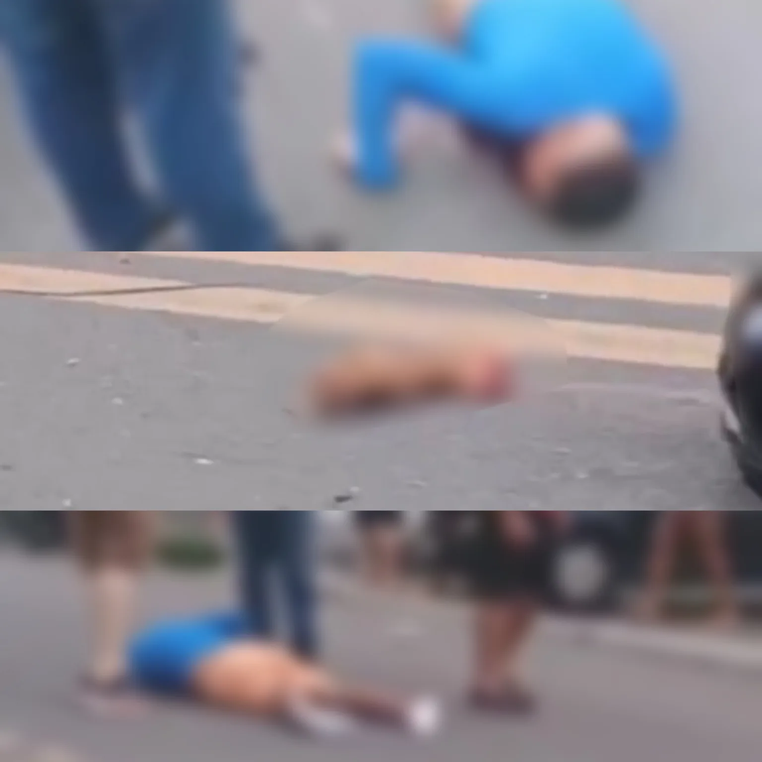 Motociclista sofre grave acidente e tem mão decepada na Zona Norte de Manaus
