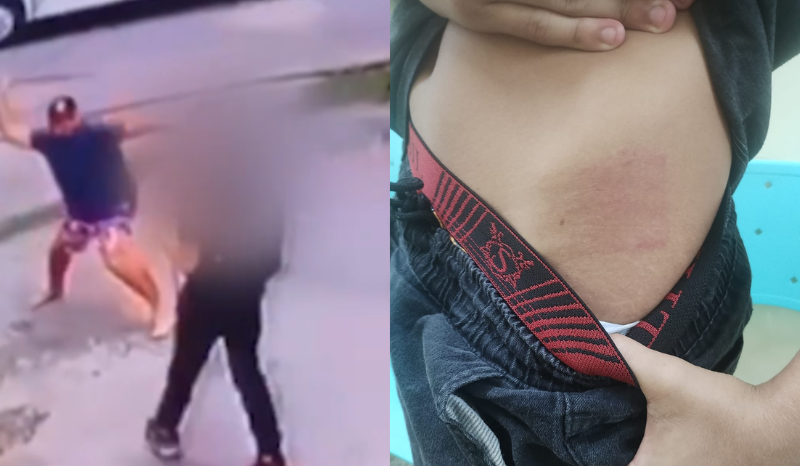 Marcas da agressão