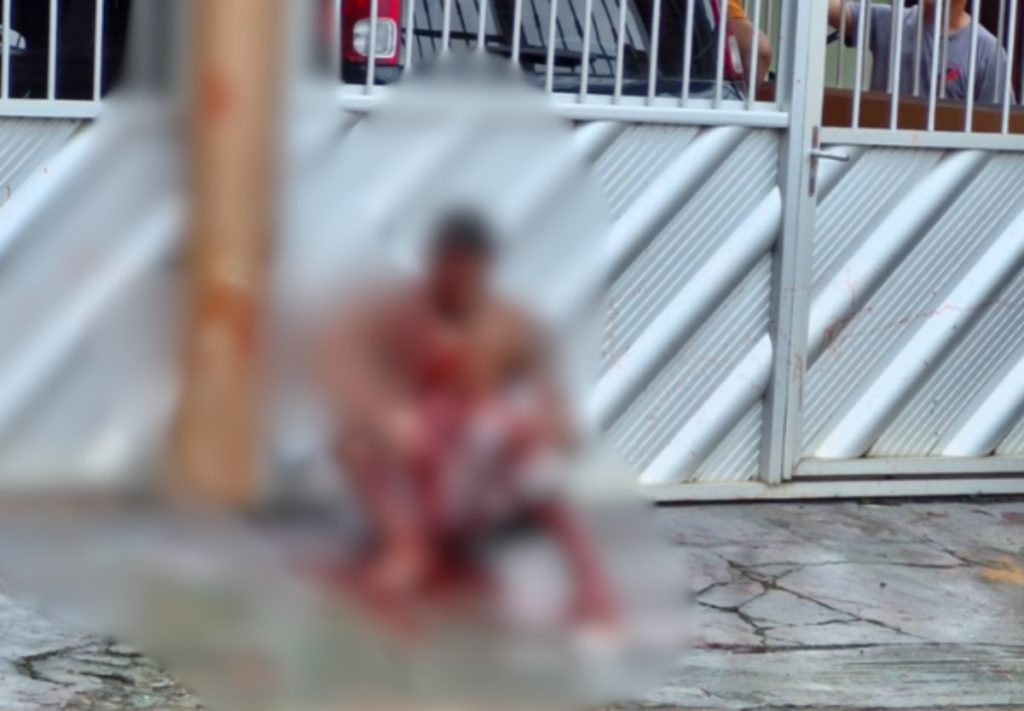 Homem leva várias terçadadas e tem dedo cortado no interior do Amazonas