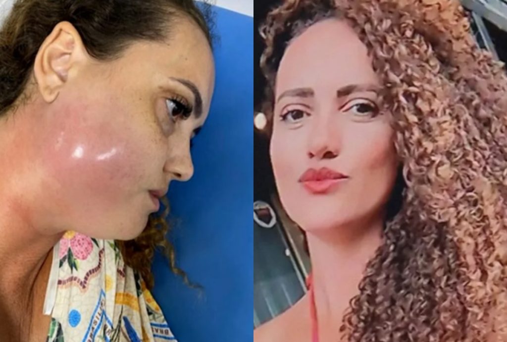 Mulher realiza procedimento dentário e morre após infecção generalizada