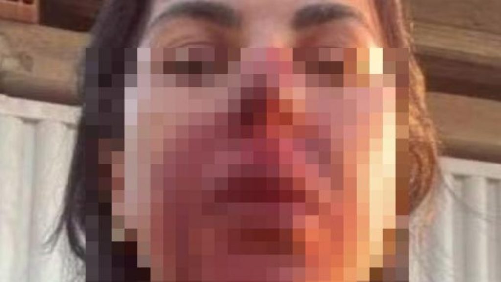 PM é preso após atacar e dar cabeçada em rosto de oficial de Justiça - Policial agride oficial de Justiça em Ibirité