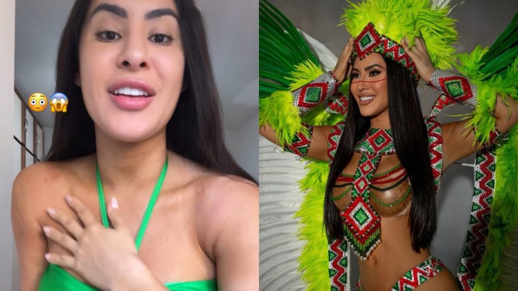 Vídeo: Isabelle Nogueira mostra hematomas após usar fantasia de Carnaval: "Marca da arte"