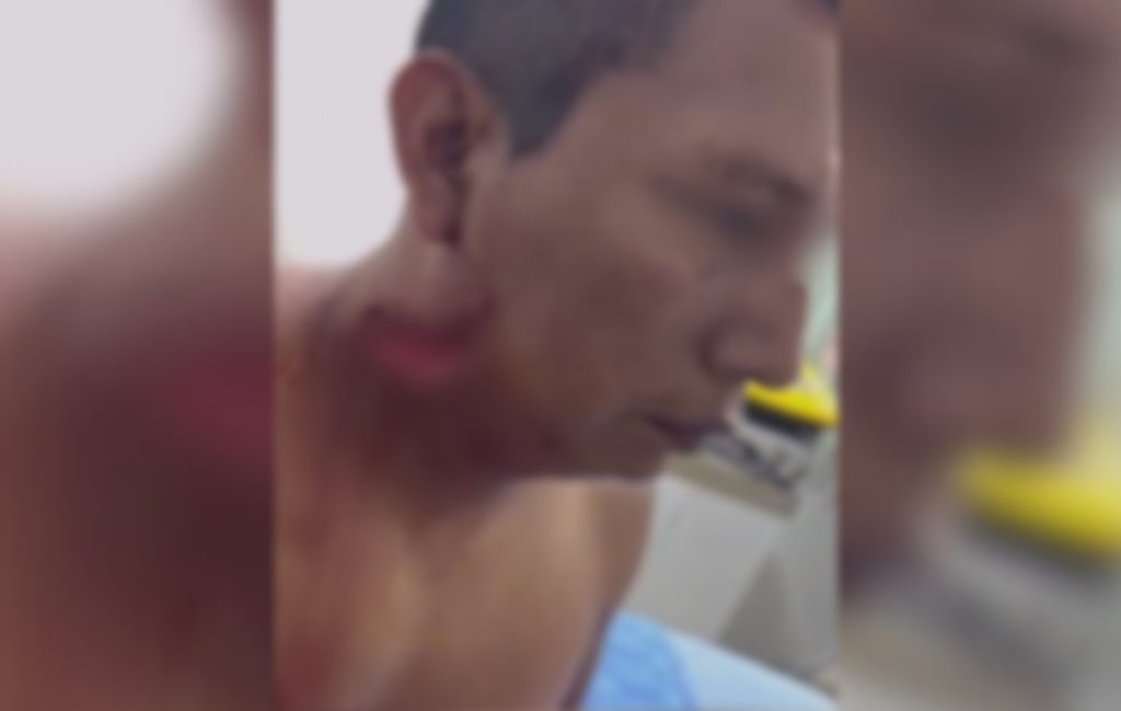 taxista atacado por passageira no Amazonas