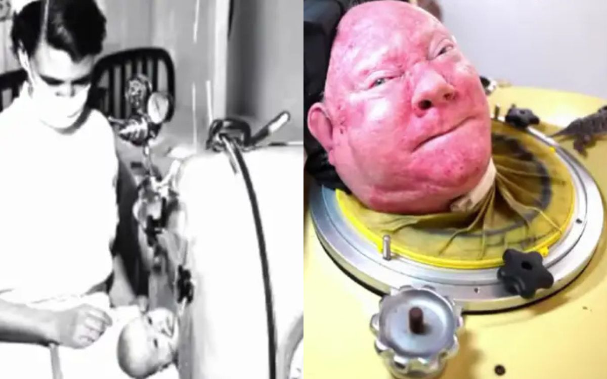 O pulmão de aço: esse homem utilizava pulmões de aço para se manter vivo