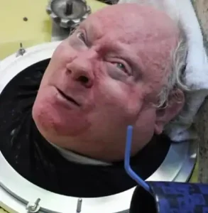 O pulmão de aço: esse homem utilizava pulmões de aço para se manter vivo