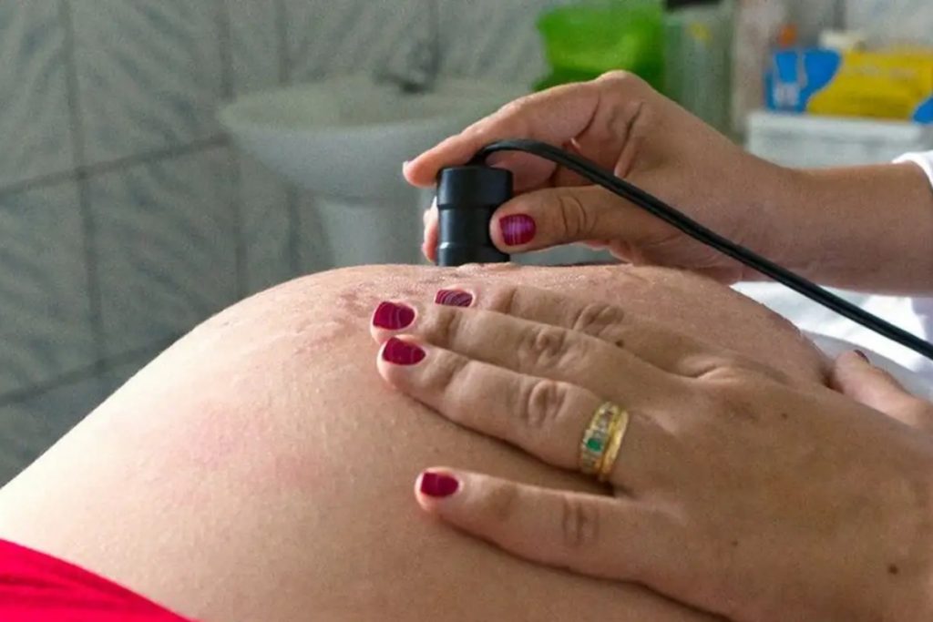 Foto: © Arquivo/MDS