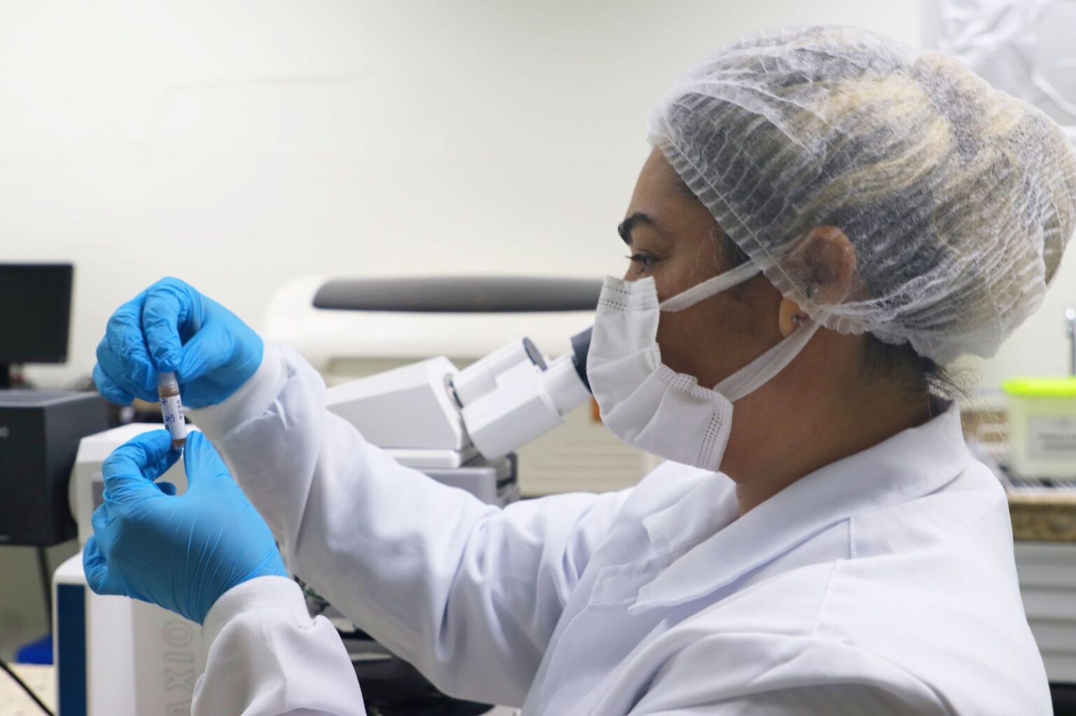 Manaus registra 7,5 mil casos de ISTs em 2025 e aponta queda de 4,04%