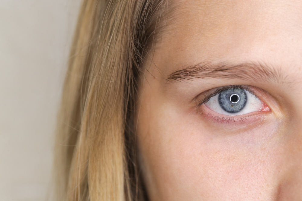 celebridades com olhos Sanpaku