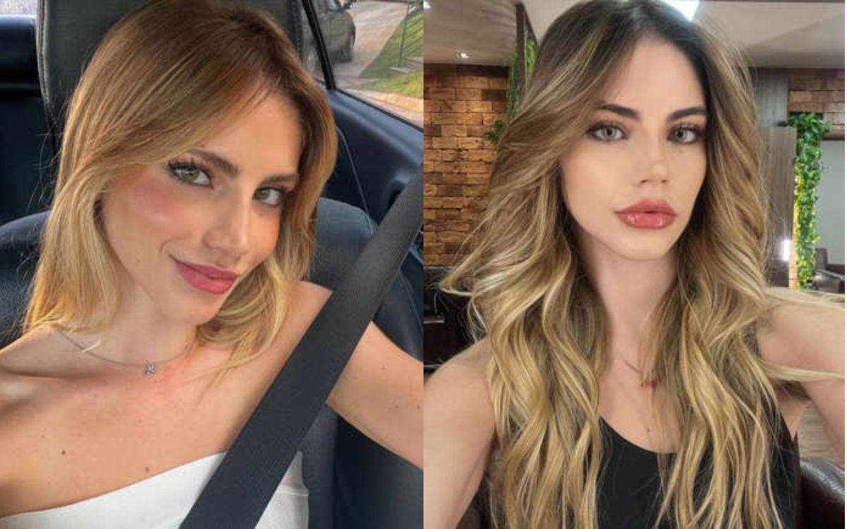 Influenciadora descobre síndrome rara após dica de seguidora