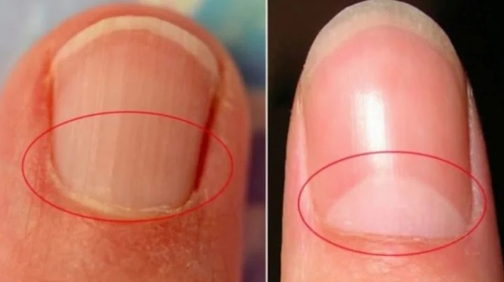 Meia-Lua na unha: o que a lúnula revela sobre sua saúde
