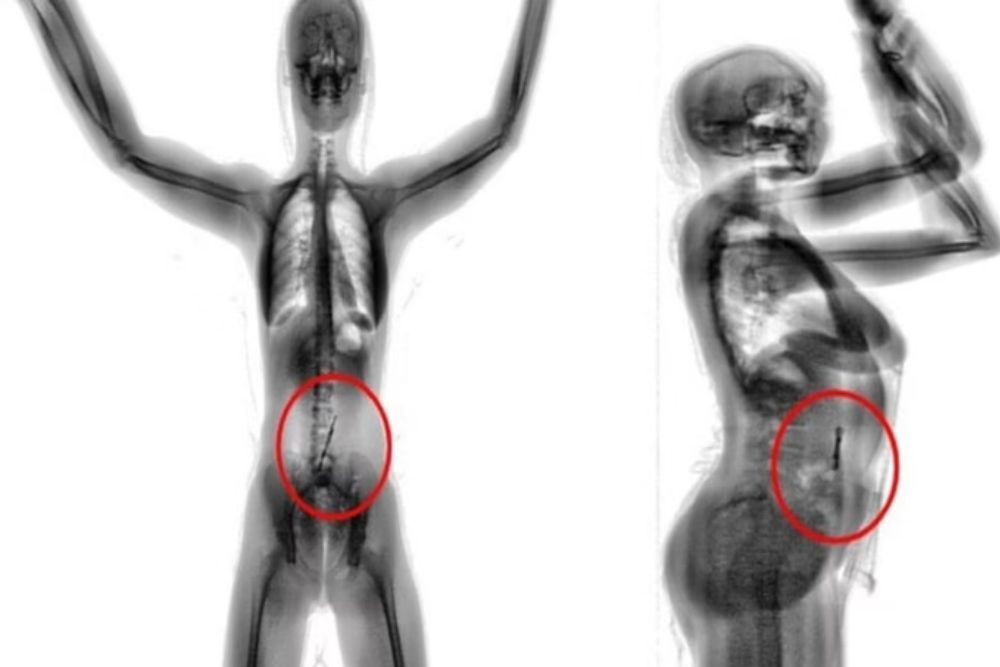 Mulher é flagrada com drogas e lâmina escondidas no corpo durante revista com scanner em presídio