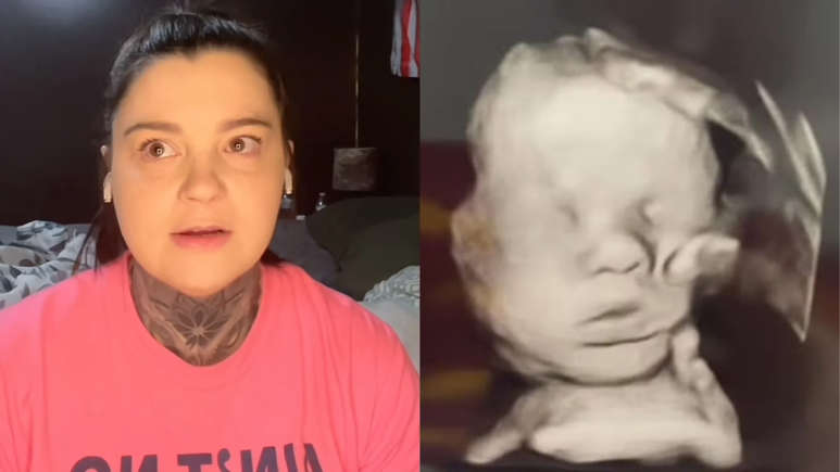 Após orar, mãe diz que 'mão de Deus' apareceu em seu ultrassom: "Não sei explicar de outra forma"