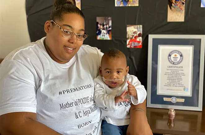 Histórida do bebê mais prematuro do mundo, inspira com sua história de superação