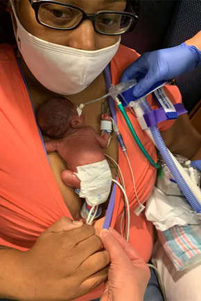 O bebê mais prematuro do mundo, inspira com sua história de superação