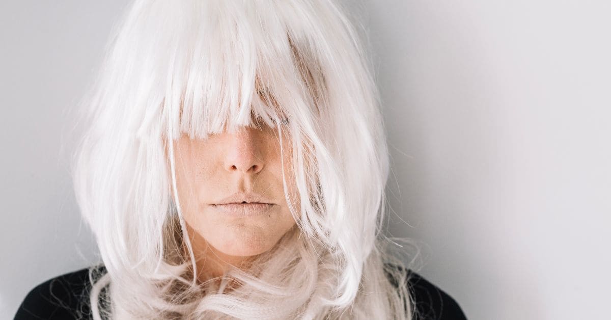 Cabelo branco em jovens é normal