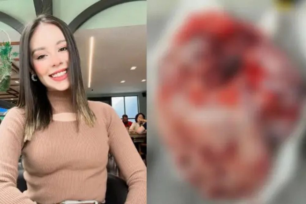 Jovem de Manaus luta contra câncer agressivo e precisa de ajuda urgente; saiba como contribuir