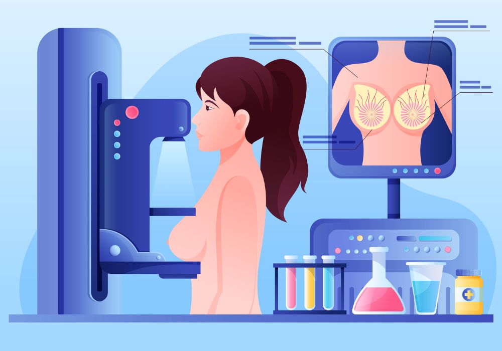 mamografia a partir dos 40 anos