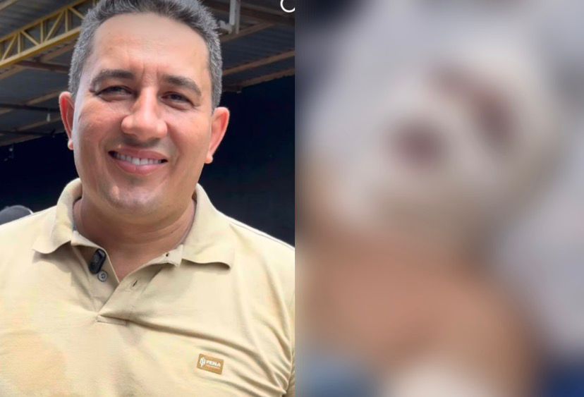 Veja como ficou o ex-prefeito de Borba, Simão Peixoto, após explosão em lancha