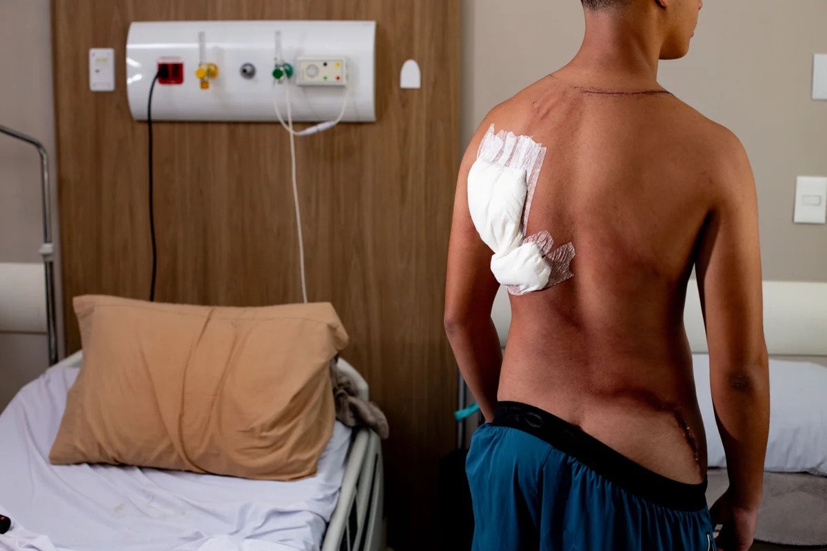 adolescente eduardo linhares recebe alta hospitalar após queimaduras em manifestação