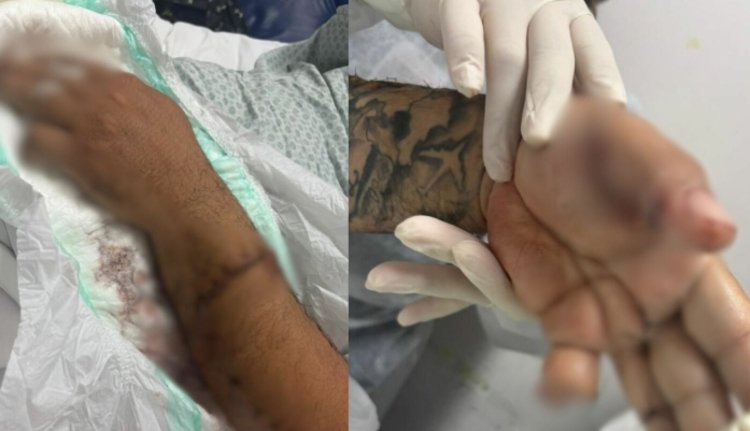Motorista de app é atacado a terçadadas por passageiro em Manaus