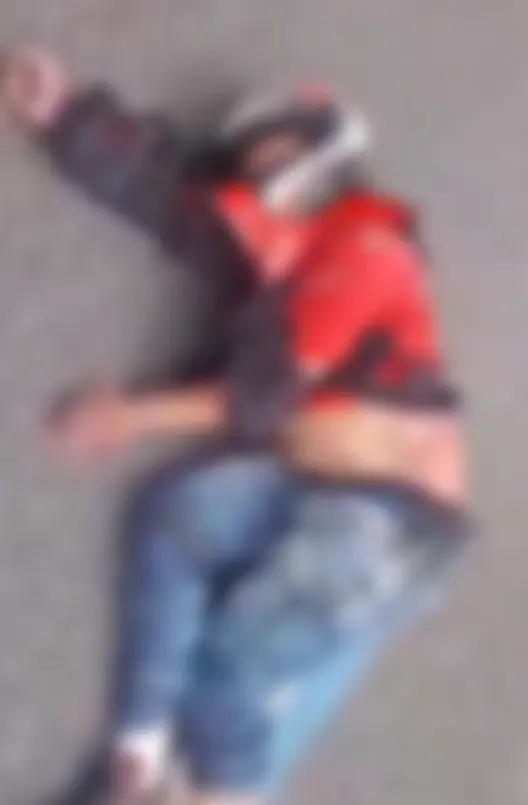 motociclista gravemente ferido após colisão com caminhão