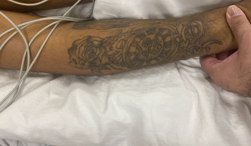 imagem de tatuagens do paciente internado no hospital