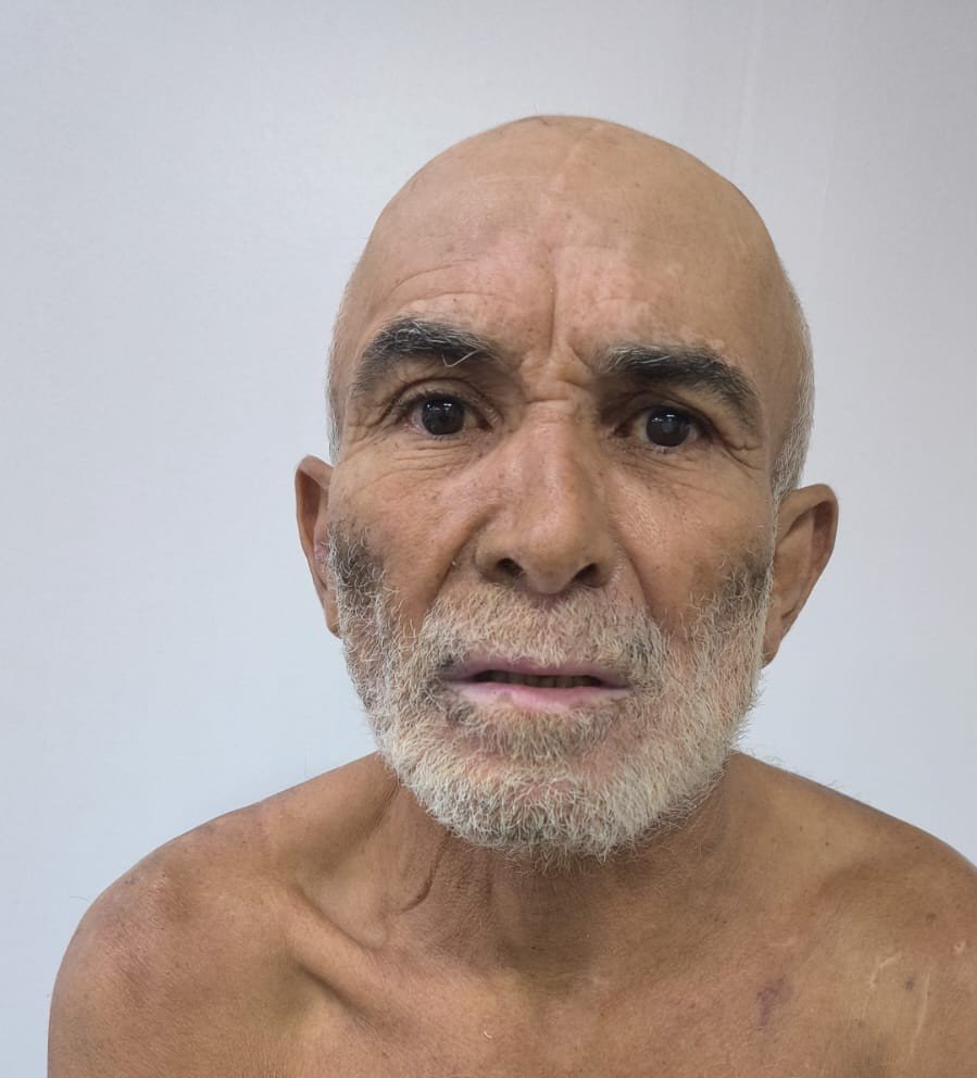 Hospital Dr. João Lúcio solicita ajuda para encontrar familiares de paciente internado