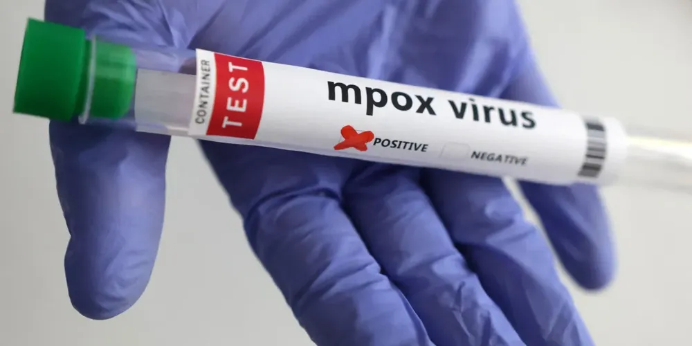 Infográfico ilustrativo sobre o aumento de casos confirmados de Mpox no Brasil e orientações de saúde.