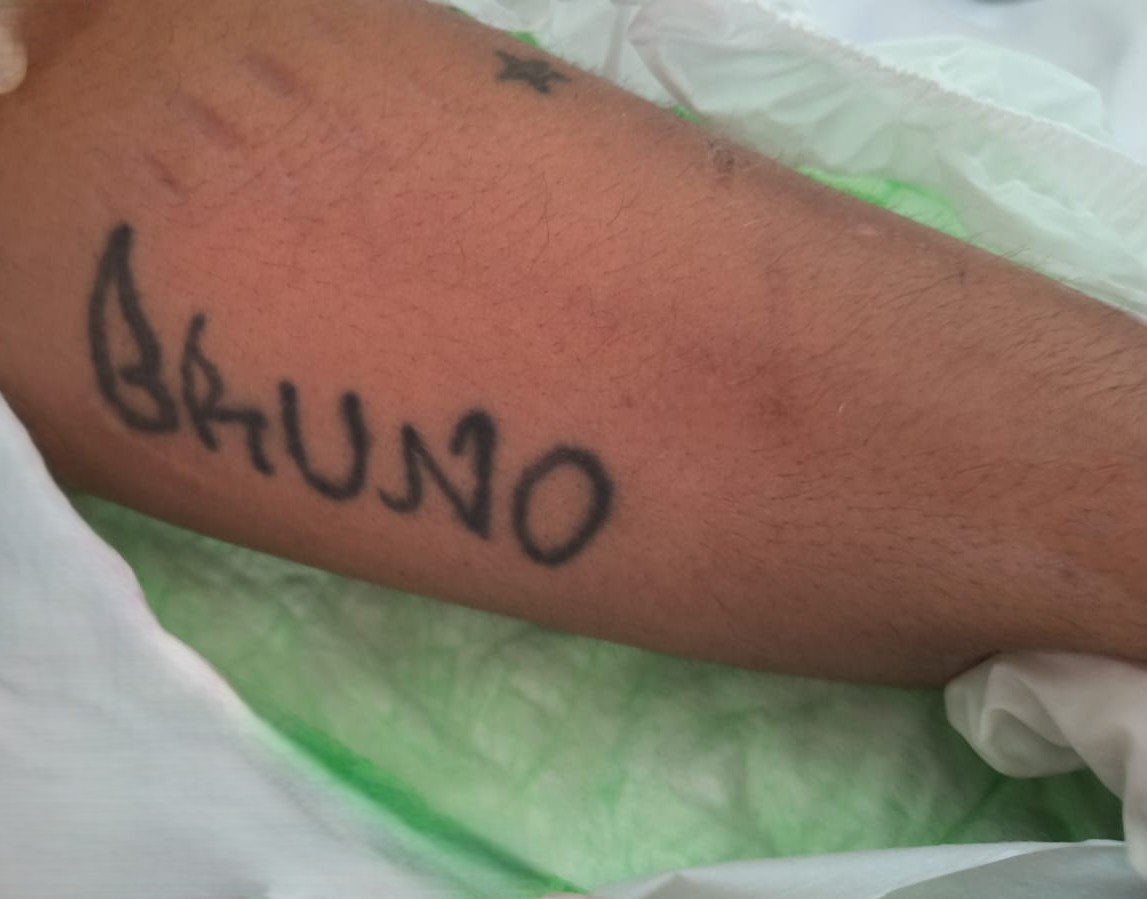 Fotografia detalhada de tatuagens no corpo de um homem para auxiliar na identificação de paciente em hospital de Manaus.