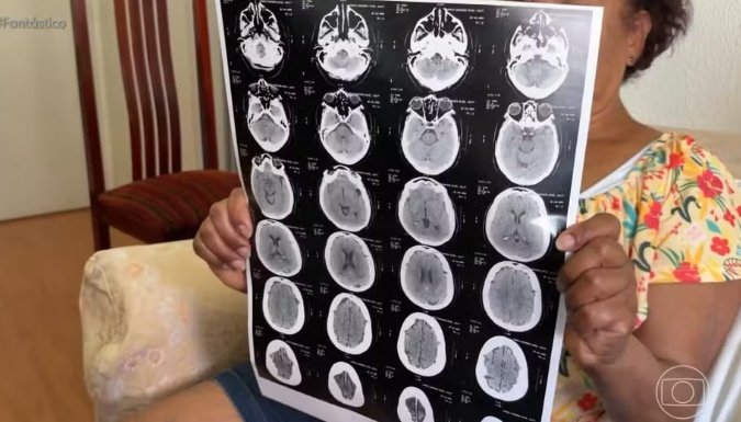 Representação de alerta contra fraudes e o golpe do falso exame médico que utiliza dados reais de pacientes