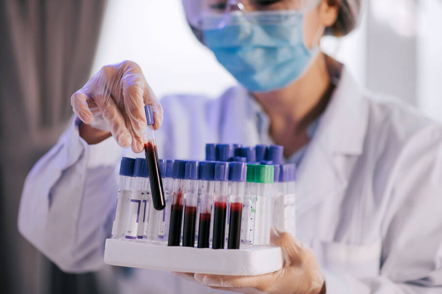 Cientista em laboratório realiza análise de amostras de sangue para diagnóstico precoce de câncer de mama.