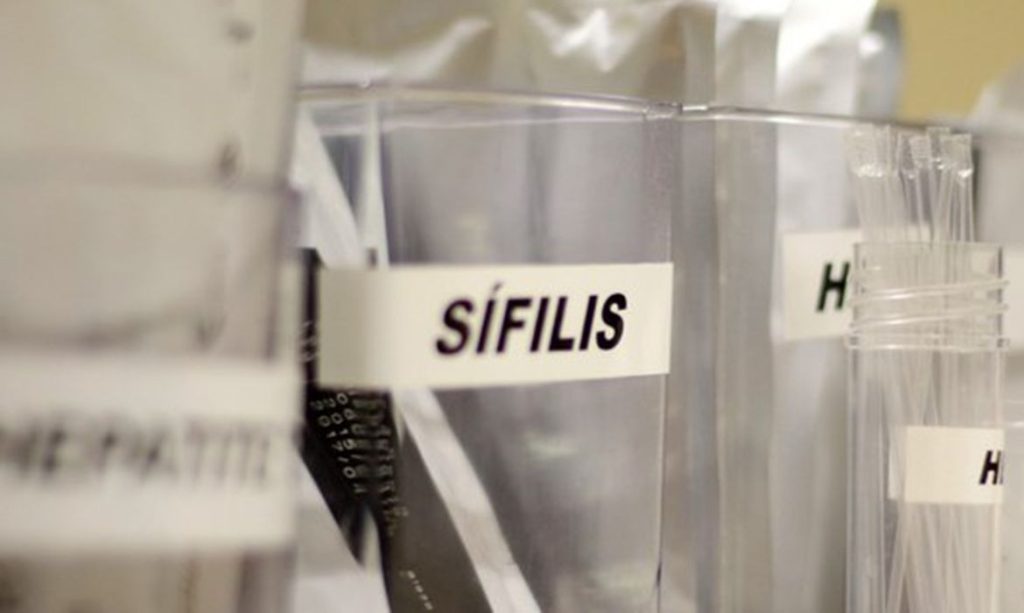 Frascos de medicamento antibiotico doxiciclina em ambiente hospitalar para prevencao de infeccoes bacterianas
