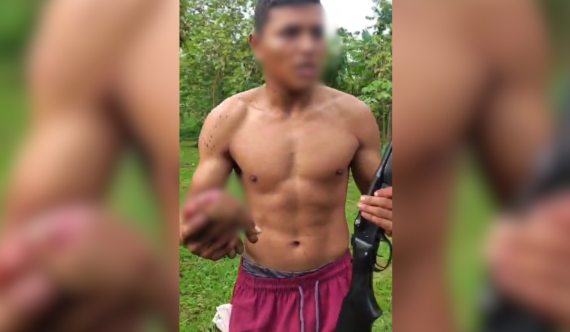 Homem ferido após briga entre vizinhos na comunidade Canabuoca II em Manacapuru Amazonas