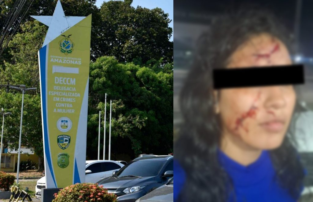 Mulher ferida no rosto após ser agredida com prato quebrado pelo ex em Manaus