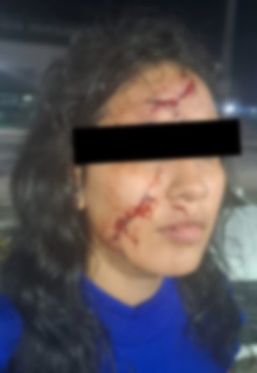 Mulher ferida no rosto após ser agredida com prato quebrado pelo ex em Manaus