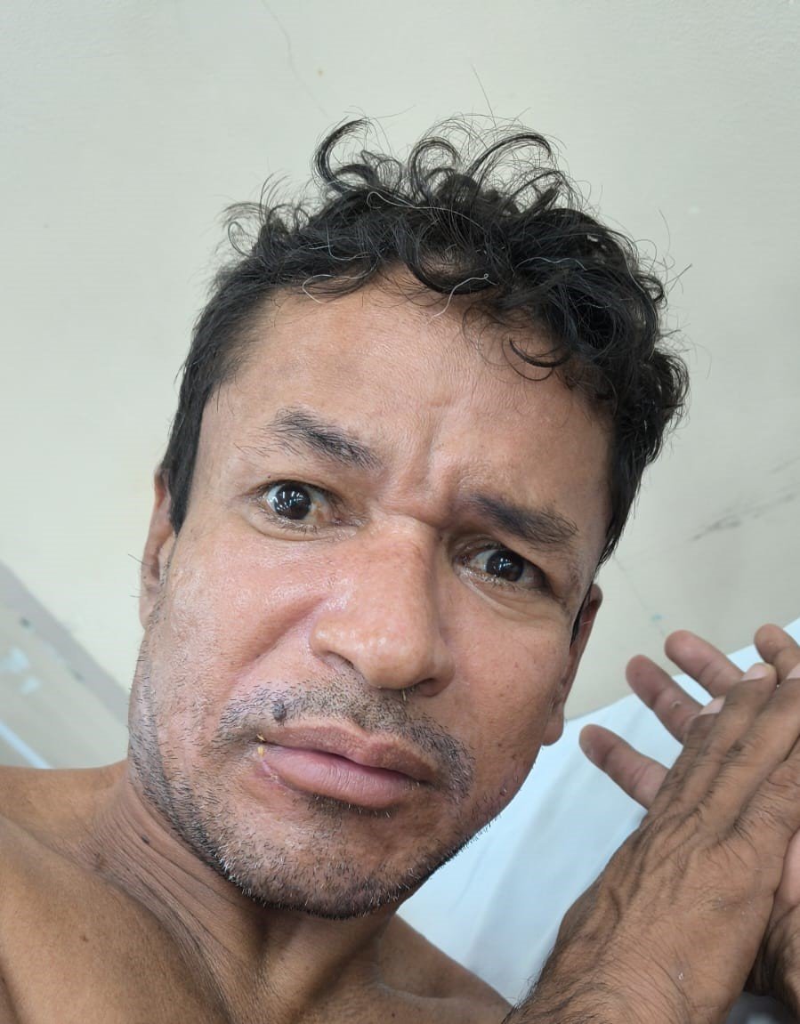 Paciente Wallace internado no Hospital João Lúcio em Manaus aguardando contato de familiares