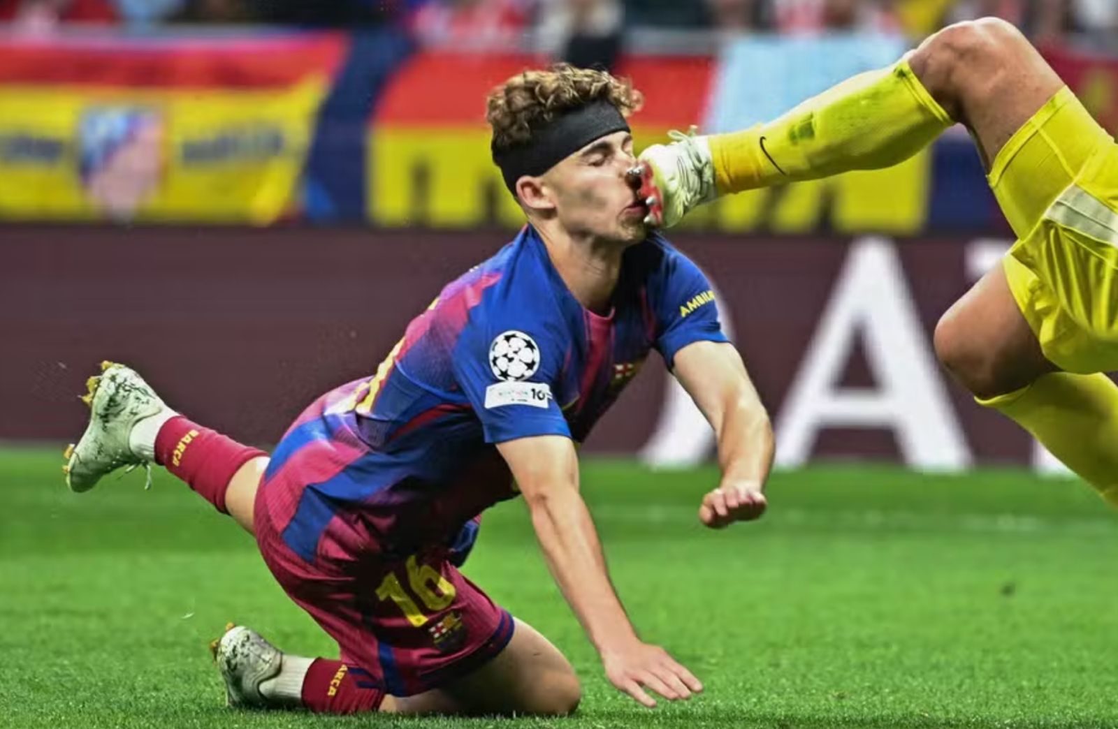 Fermín López do Barcelona com fratura no pé direito